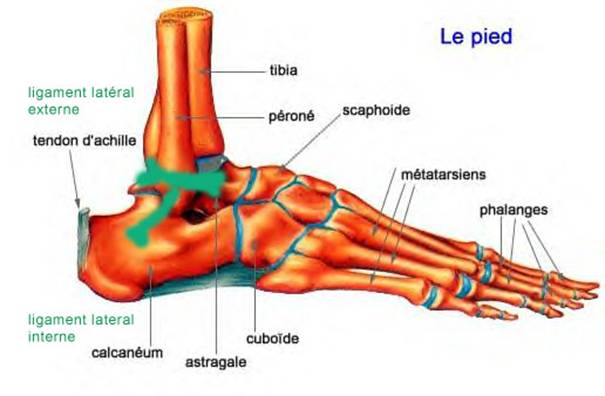 Entorses de la cheville, pathologie et intervention chirurgicale